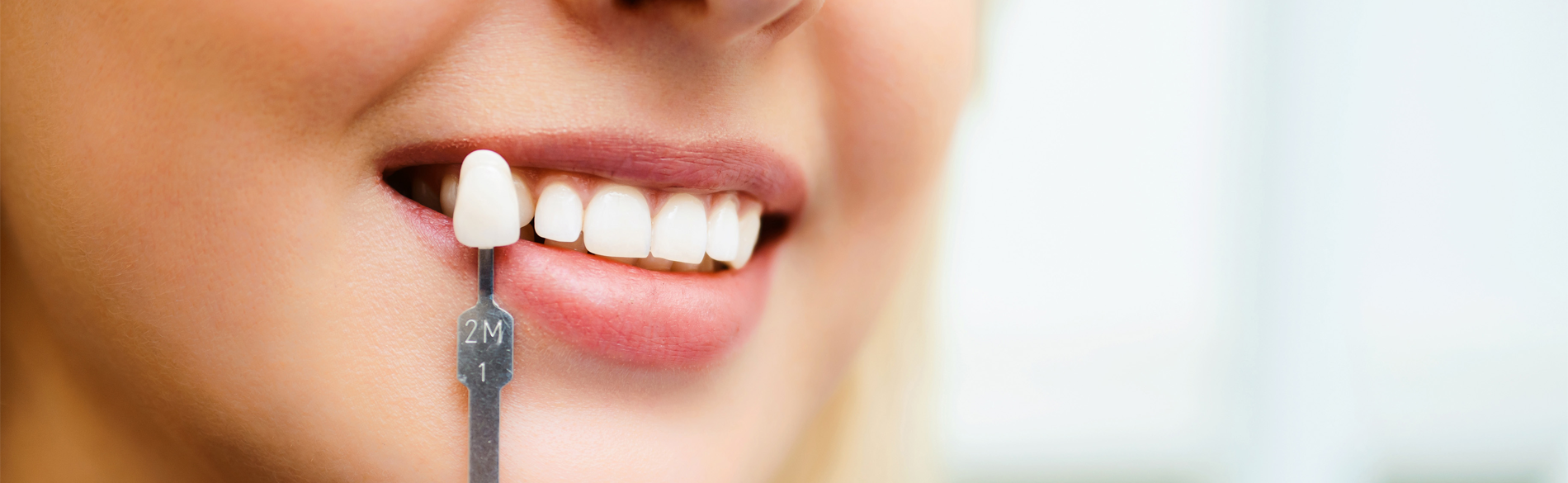 Braces Treatment: Aesthetic and Functional Benefits
