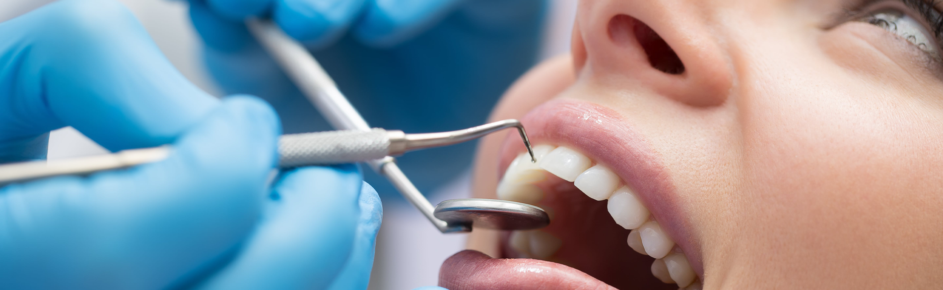 Symptoms and Prevention of Gum Diseases